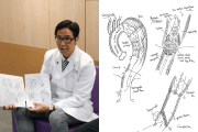 일본인 흉부외과 전문의, 정교한 스케치로 홍콩 환자들과 소통하며 복잡한 대동맥 수술 이해 도와.png