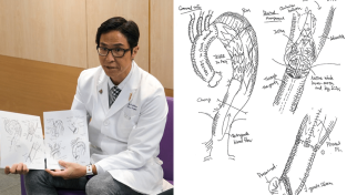 일본인 흉부외과 전문의, 정교한 스케치로 홍콩 환자들과 소통하며 복잡한 대동맥 수술 이해 도와.png