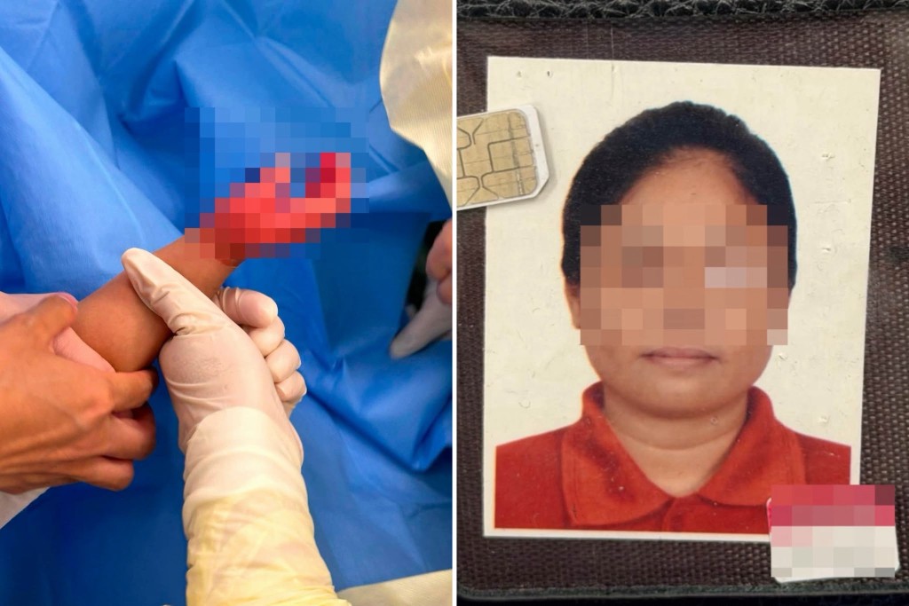 가정부의 잔혹한 아동 학대… 23개월 아기 손에 화상 입히고 껍질 벗겨질 때까지 방치.jpeg